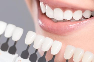 Traitement pour des dents blanches parfaites