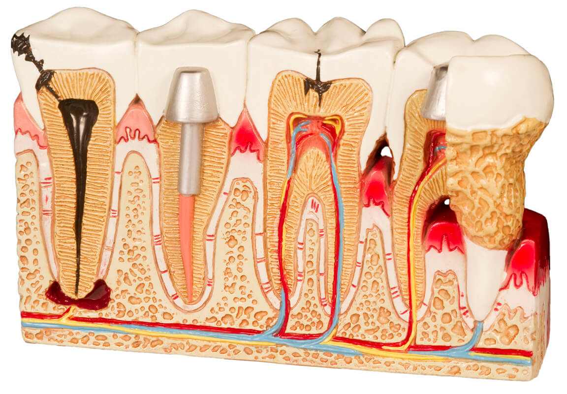 Soins complets des pathologies dentaires