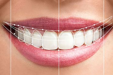 Dentisterie esth&eacute;tique & cosm&eacute;tique