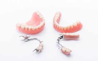 Prothèses dentaires amovibles