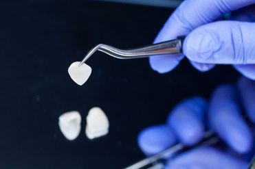 Facettes dentaires en c&eacute;ramique