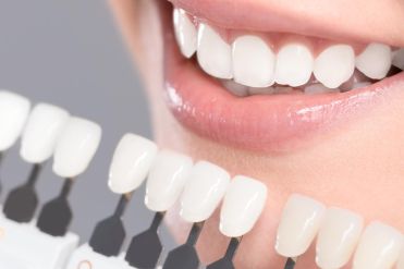 Traitement pour des dents blanches parfaites